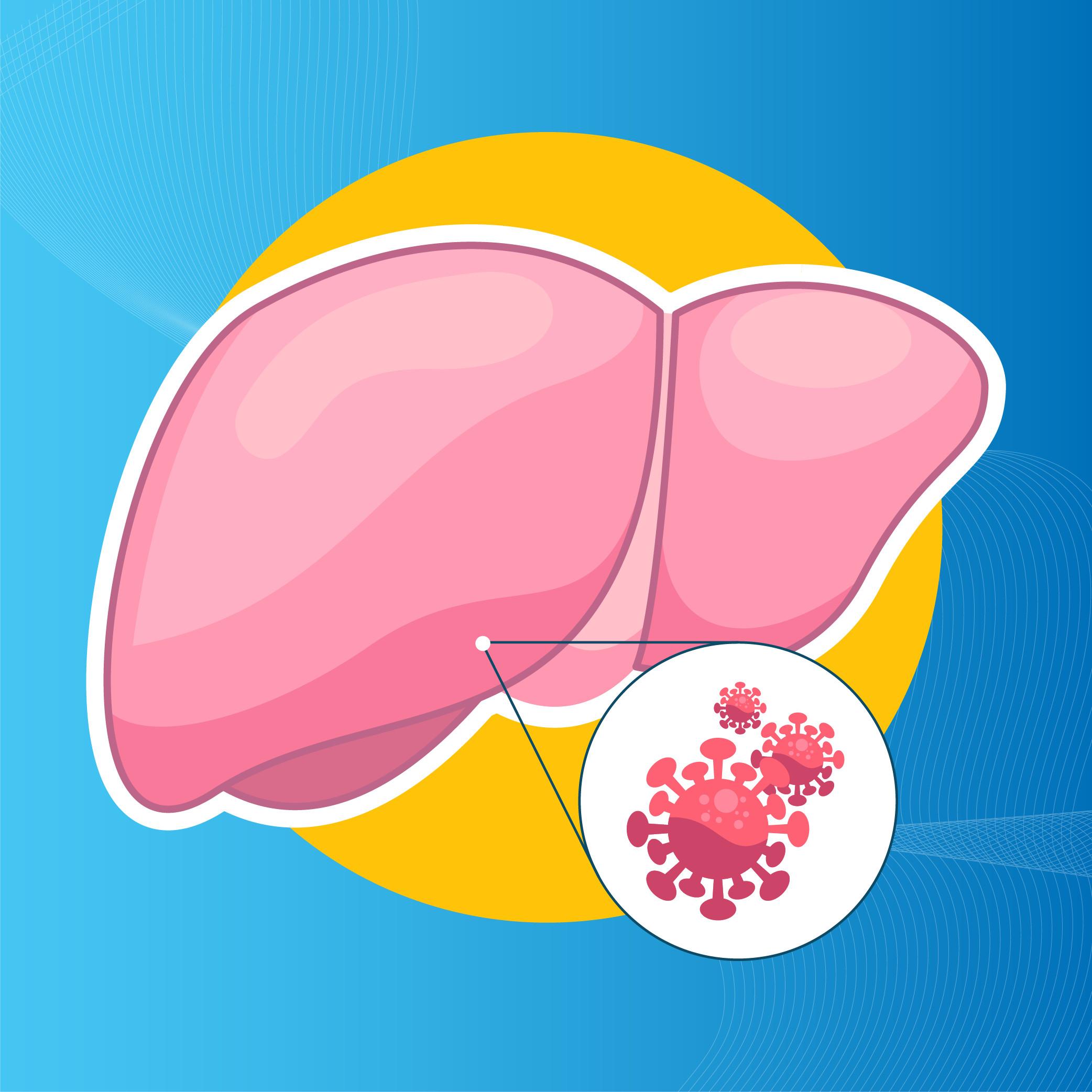 Bệnh viêm gan B còn nguy hiểm hơn bệnh HIV